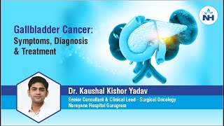 Gallbladder Cancer Symptoms Diagnosis and Treatment  Dr Kaushal Yadav [upl. by Lewse542]