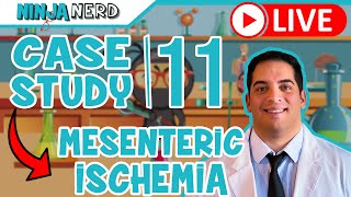 Case Study 11 Acute Mesenteric Ischemia [upl. by Aehsan737]