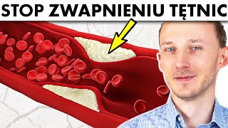 Wapń w tętnicach i mózgu zwapnienie tętnic 12 sposobów jak temu zapobiec  Dr Bartek Kulczyński [upl. by Neelhtak]