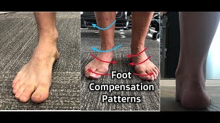 Foot Compensation Patterns [upl. by Terence421]