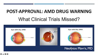 PostApproval Insights Adverse Events of AMD Treatments – Pegcetacoplan Faricimab amp Brolucizumab [upl. by Wootan304]