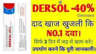 Dersol 40 ointment  Dersol 40 ointment uses  Dersol cream reviewin Hindi दाद खाज खुजली [upl. by Baptist]