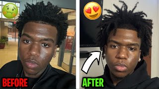 How To Make Your Freeform Dreads Lock Faster Overnight [upl. by Ahsataj]