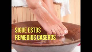 Recomendaciones para eliminar los hongos en los pies [upl. by Norina]