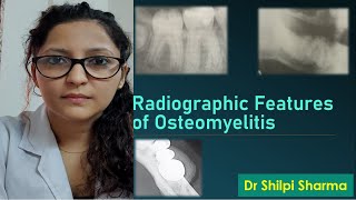 Radiographic Features of Osteomyelitis [upl. by Artimas]