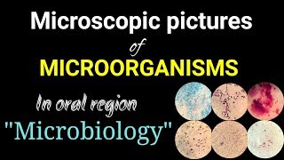 Microscopic pictures of microorganismsmicrobiology pictures of microorganismsDr Poojireddy [upl. by Etteloc]