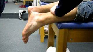 Normal Achilles Thompson Test [upl. by Daffie]