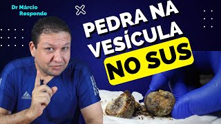 Cirurgia de PEDRA NA VESÍCULA aberta ou por vídeo  Colecistectomia videolaparoscópica e aberta [upl. by Anthea]