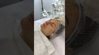 Cosmetology skin treatment acne treatment antiage therapy BioRePeel ✨ [upl. by Ahsinyd574]