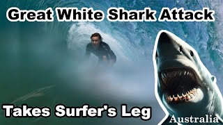 Shark Attack Takes Surfers Leg Kai McKenzie Australian Shark Attacks [upl. by Enened]