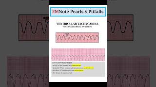 ACLS Cardiac Arrhythmias [upl. by Ennylcaj]