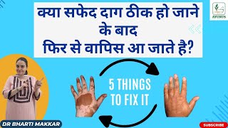 5 tips to prevent Reoccurrence of white patches after 100 recovery in Vitiligo by Dr Bharti Makkar [upl. by Topliffe]