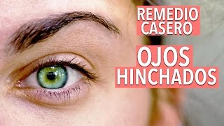 COMO QUITAR LOS OJOS HINCHADOS OJERAS Y BOLSAS EN LOS OJOS  YASMANY [upl. by Collen89]