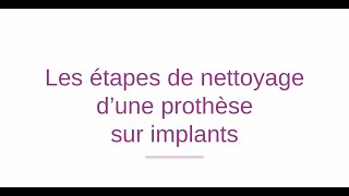 Les étapes de nettoyage dune prothèse sur implants [upl. by Marrissa]