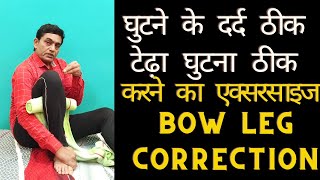 knee pain exercises  knee pain relief exercises  bow legs correction exercises [upl. by Billen137]