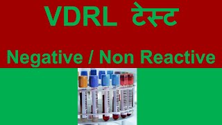 vdrl test negative in hindi  vdrl test non reactive meaning in hindi [upl. by Winterbottom609]