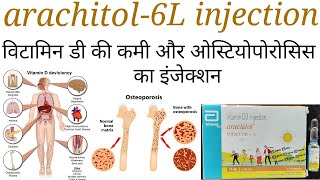 Arachitol 6L injectioncholecalciferol 600000iuvitamin d3 injection ke fayde upyog in hindi [upl. by Oniram70]