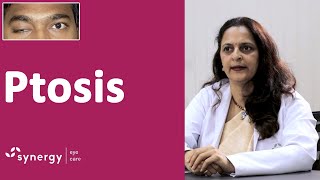 What is ptosis Ptosis Causes and Treatment [upl. by Sitoel]