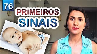 SINAIS  CARACTERÍSTICAS DO AUTISMO EM BEBÊS [upl. by Dorette]