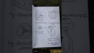 Assignment on valvular heart disease MSNIIgnm2ndyear bscnursing assignment notes study [upl. by Varin]