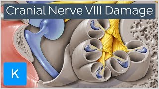 What happens when the vestibulocochlear nerve is damaged  Human Anatomy  Kenhub [upl. by O'Grady]