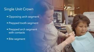 iTero Element™ intraoral scanner tutorial create digital impressions for a single unit crown [upl. by Leggett]