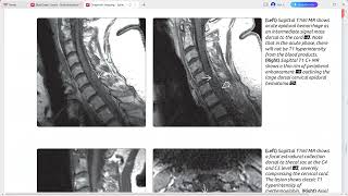 SPINE IMAGING DIAGNOSTIC IMAGING SERIES [upl. by Htiffirg]