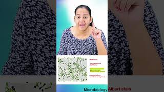 1 minute learning Corynebacterium diphtheriae Chinese letter arrangement [upl. by Bazar]