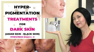 Hyperpigmentation Treatments for Dark Skin [upl. by Willmert]