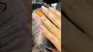 Scalp Treatment and Combing for Dry Scalp scalptreatment [upl. by Ikiv]