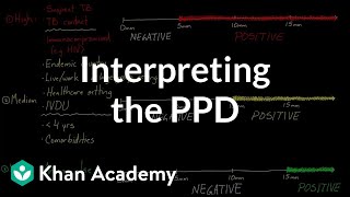 Interpreting the PPD  Infectious diseases  NCLEXRN  Khan Academy [upl. by Izawa245]