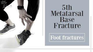 5th Metatarsal Base Fracture  foot fracture [upl. by Myrtia]