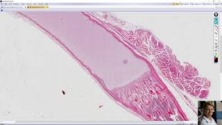 endochondral ossification [upl. by Weiler]