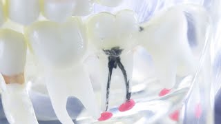 Discover the Importance of Periodontists  Who Are They and How Can They Help You Maintain a Healt [upl. by Eurydice]