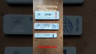 HIV HCV HbSag test  HIVHbSagHCV test kaise kare  pathology medical shorts [upl. by Ahsilet]