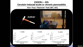 Treatment of visceral pain  lessons from pancreatitis basic mechanisms by Ihsan Ekin Demir [upl. by Elleron978]