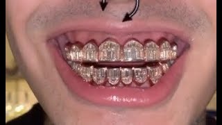 Lil Pump Spends 1M On Rose Gold Baguette Diamond Grill [upl. by Lucilla89]