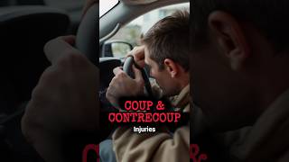 Coup and Contrecoup Head Injury shorts youtubeshorts [upl. by Ylak]