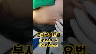 턱관절치료 근육이완치료 분사신장요법 spray amp stretch 부산 사하구 하단 드림치주과 치과 [upl. by Atiloj597]