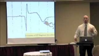 The 6 Causes ST Segment Elevation on an EKG ECG [upl. by Selym]