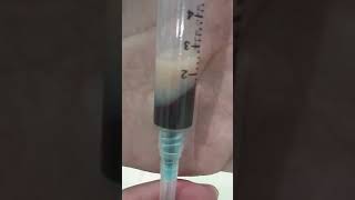 lipemic sample  lipemic tg cholesterol lipidprofile viralvideo viralyoutubevideo medical [upl. by Krum]