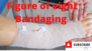 Figure of Eight Bandaging by PC nursing procedure [upl. by Canning]