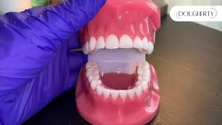 Dougherty Orthodontics  Clear Retainer Care [upl. by Oregolac]