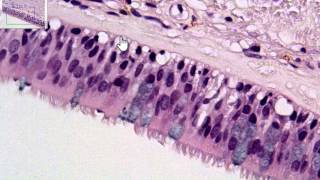 Pseudostratified Columnar P1 [upl. by Cutter]