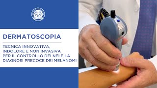 Dermatoscopia  tecnica per il controllo dei nei e la diagnosi precoce dei melanomi [upl. by Jarv]