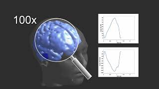 Impedance Change of Brain Pulsation [upl. by Delfine]