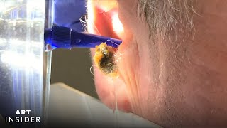 Water Device Painlessly Removes Earwax  Art Insider [upl. by Urquhart251]