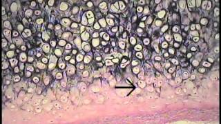 Cartilage and Bone Histology FreeMedEd [upl. by Ahsinna15]