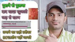 Terbinaforce plus nf cream use benefits and Side effects full review in hindi [upl. by Rhiana]