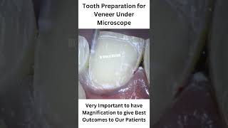 microscopicdentistry dentistinkarnal drneerajnarang bestdentistry [upl. by Curt]